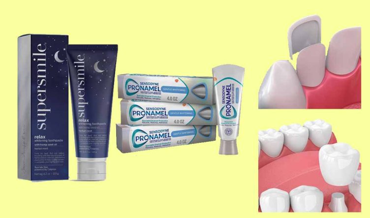 buying guide to toothpaste for crown and veeners